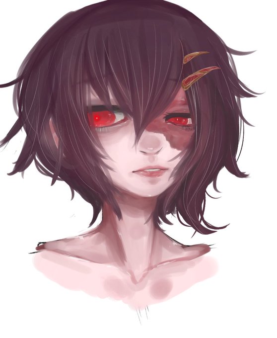 火傷のtwitterイラスト検索結果 火傷のtwitterイラスト検索結果