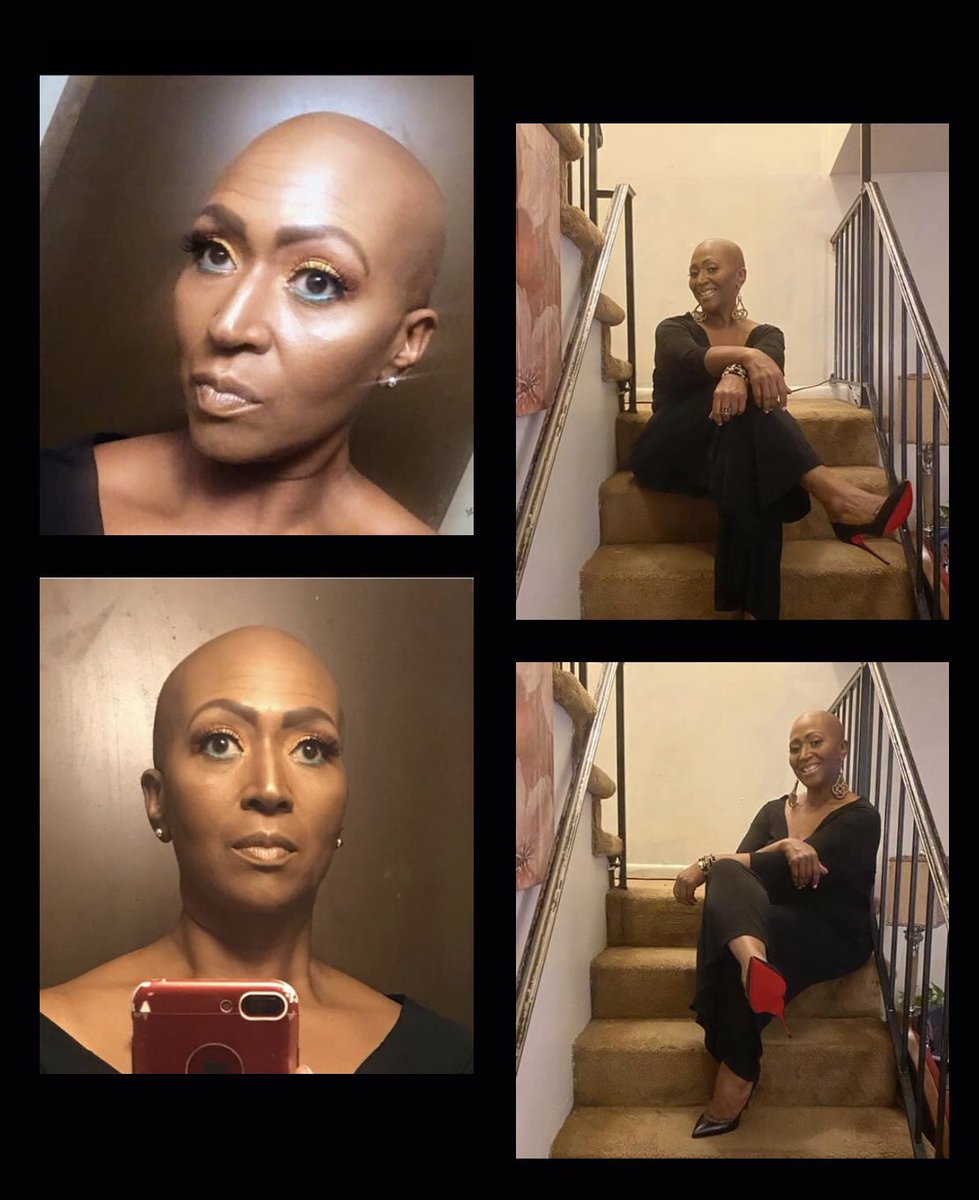 reseplus2's tweet photo. Playing the cards I’ve been dealt and winning. Cancer will not win
#lovingtheskinimin
#simplelife
#fightingtheodds 
#Godsgirl https://t.co/MKnURmBTpm