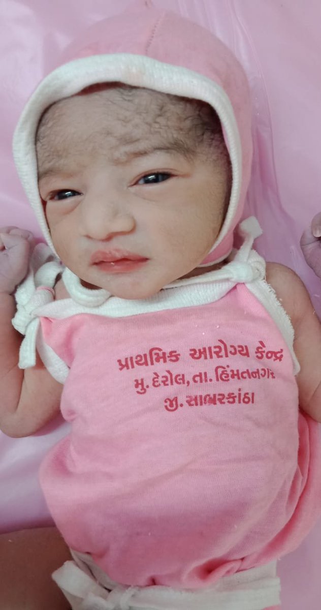 CdhoSabarkantha's tweet photo. Today 4 FullTerm Normal Delivery at #phc derol All JSSK benefit & Sanitary napkins given to beneficiary. #IBNC done.
#KMC explained. #IYCF chart explained.
#Latching explained by SN.
# Inj Vit K 1, Hep B 0 dose,B-opv 0 dose given
@JpShivahare
#happyindependenceday2020 🇮🇳 https://t.co/OM5ONwlnAI