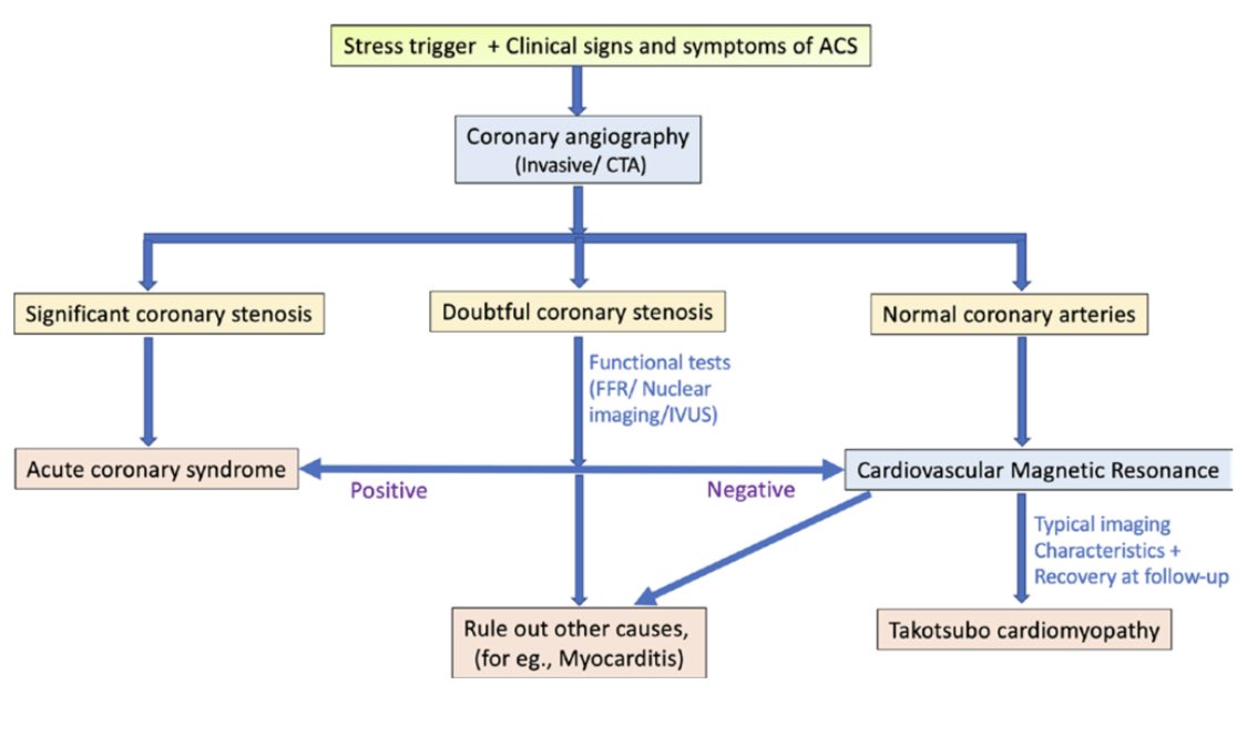 Role of  #whyCMR in Takotsubo CM (TC): reversible transient LV dysfunction most commonly basal hyperkinesis and mid-apicalLV ballooning and hypokinesia (a) other phenotypes may be present (b-d)  diffuse edema/raised T2  https://www.birpublications.org/doi/abs/10.1259/bjr.20200514