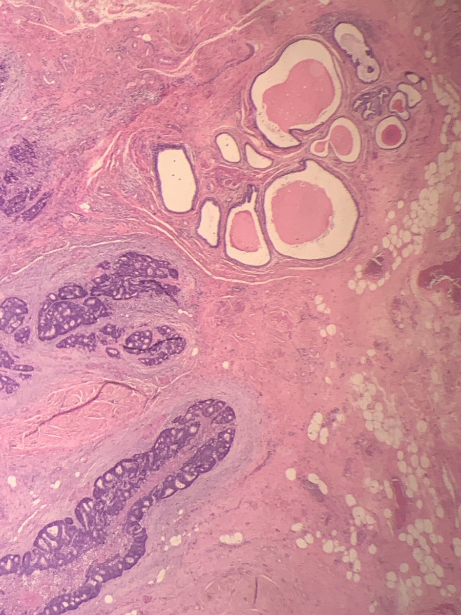 slusagar's tweet photo. #pathstories ?
(can you provide organ/site, Dx, hx?)
๐๐ฝ๐ฌ @natzpat for sharing pic w/me https://t.co/M9BWIlEjdO