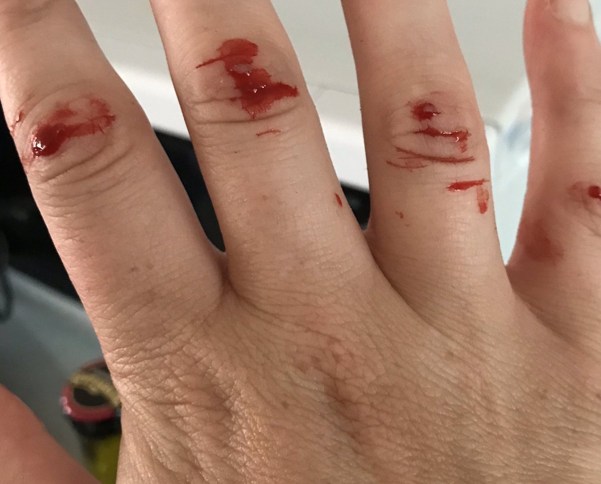 I bought some fruity cider to be a bit fancy. Unfortunately there’s no bottle opener so I done the old ‘key trick’ as you can see it went really well.