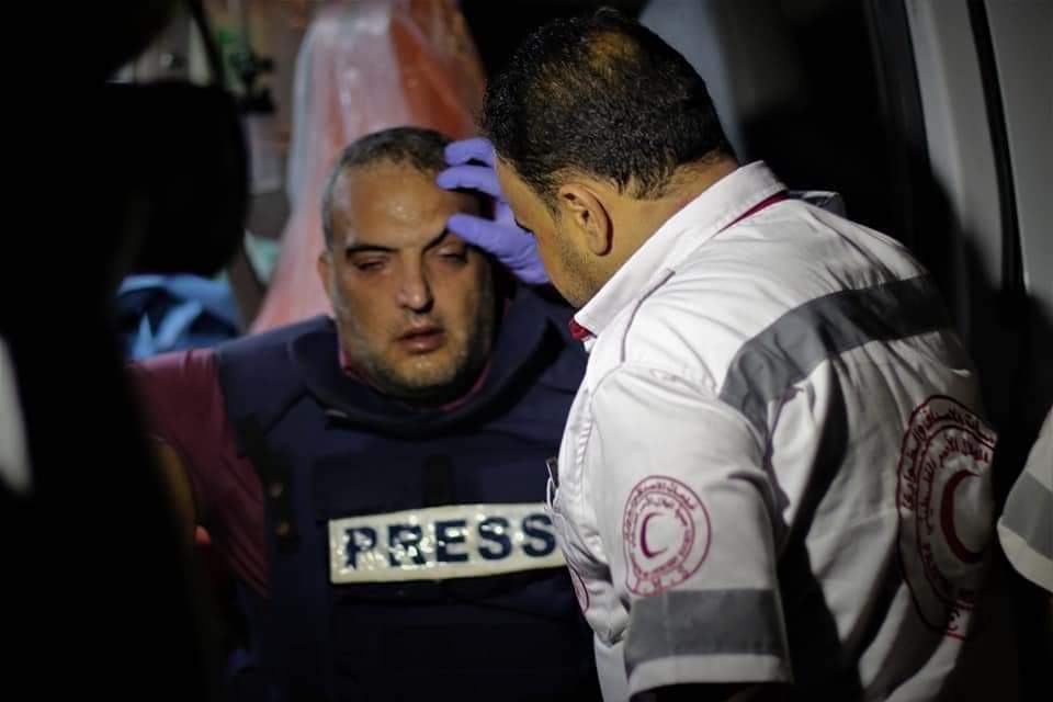 لا فرق ان ارتديت شارة الصحافة ام لا 
هذه واحدة من محاولات الاحتلال لاغتيال الصحافة
ماحدث هو طائرة مسيرة للعدو حلقت فوق مجموعة من الصحفيين يرتدون سترات تحمل شارة صحفية فسفورية القت قنابل غازية 
هذه القنابل قاتلة ولولا لطف الله لسالت دموعنا  جميعا على زملائنا 
#غزة_تحت_القصف
#عاجل