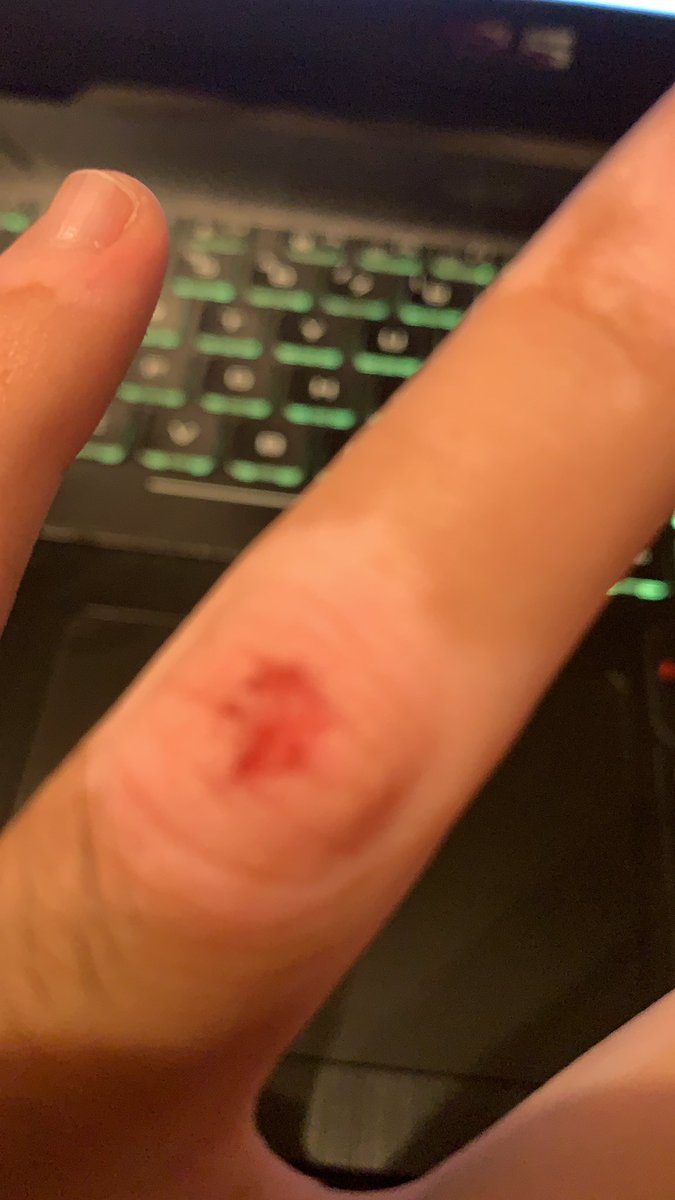 alexdelareta's tweet photo. El 5to lugar en #KOF98 me costó sangre, desde ayer que empecé a practicar combos de revista me abrí el dedo; por eso no hice Rekkas. #conelalba https://t.co/vZIPUTMrqk