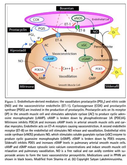 cardiopedhnn's tweet photo. 🔸Hipertension_pulmonar persistente (resistencias vasculares elevadas) del RN. Libre acceso. 

🔹PPHT of the NB. Open access.

https://t.co/ws2QwgpeUF

#cardiopedia #pedscard #HTAPP https://t.co/dm6EYZec5J