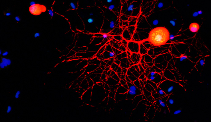 A new approach to chronic pain treatment targets a molecule that moves pain messages into nerve cell nuclei
bit.ly/3fYqQ6N