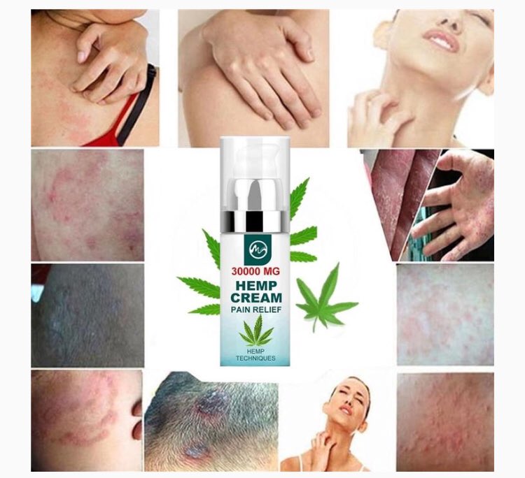 hempcbdoil2's tweet image. Need something for fast pain relief? Get the hemp cream now at effective-cbdoil.com!

#cbdusers #cbdlife #cbd #cbdhealth #cbdbenefits #cbdproducts #cbdtea #cbdoil #cbdmovement #cbdwellness #cbdgummies #cbdcommunity #cbdeducation #cbdinformation #cbdskincare #cbdheals