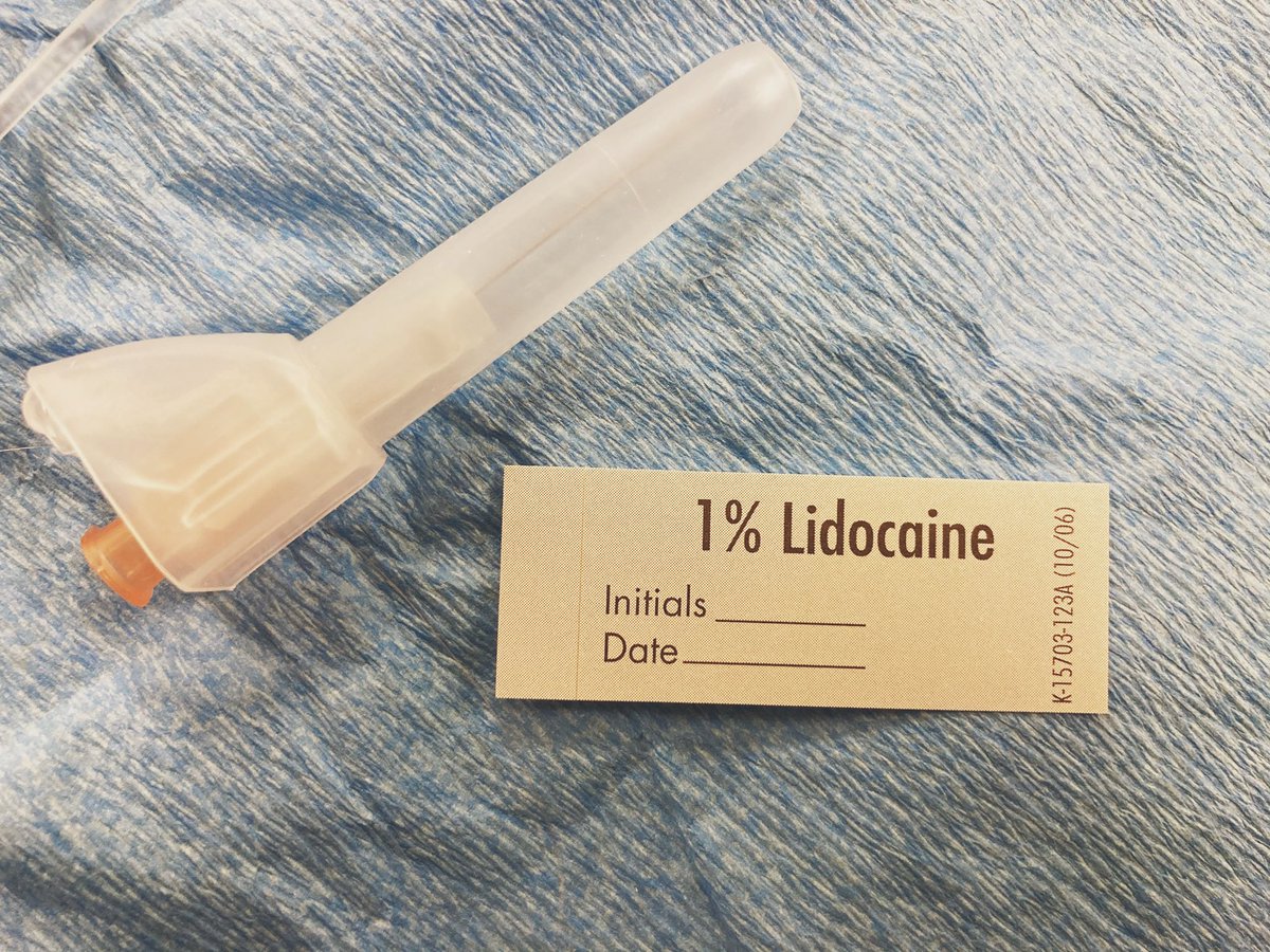 I do the same routine every line whether the patient is sedated or awake. This helps me not forget stuff.I prep, then drape when I’m ready to stick (the drape makes people hot and anxious).I always lidocaine under ultrasound—gives me the opportunity to catch a flipped probe.