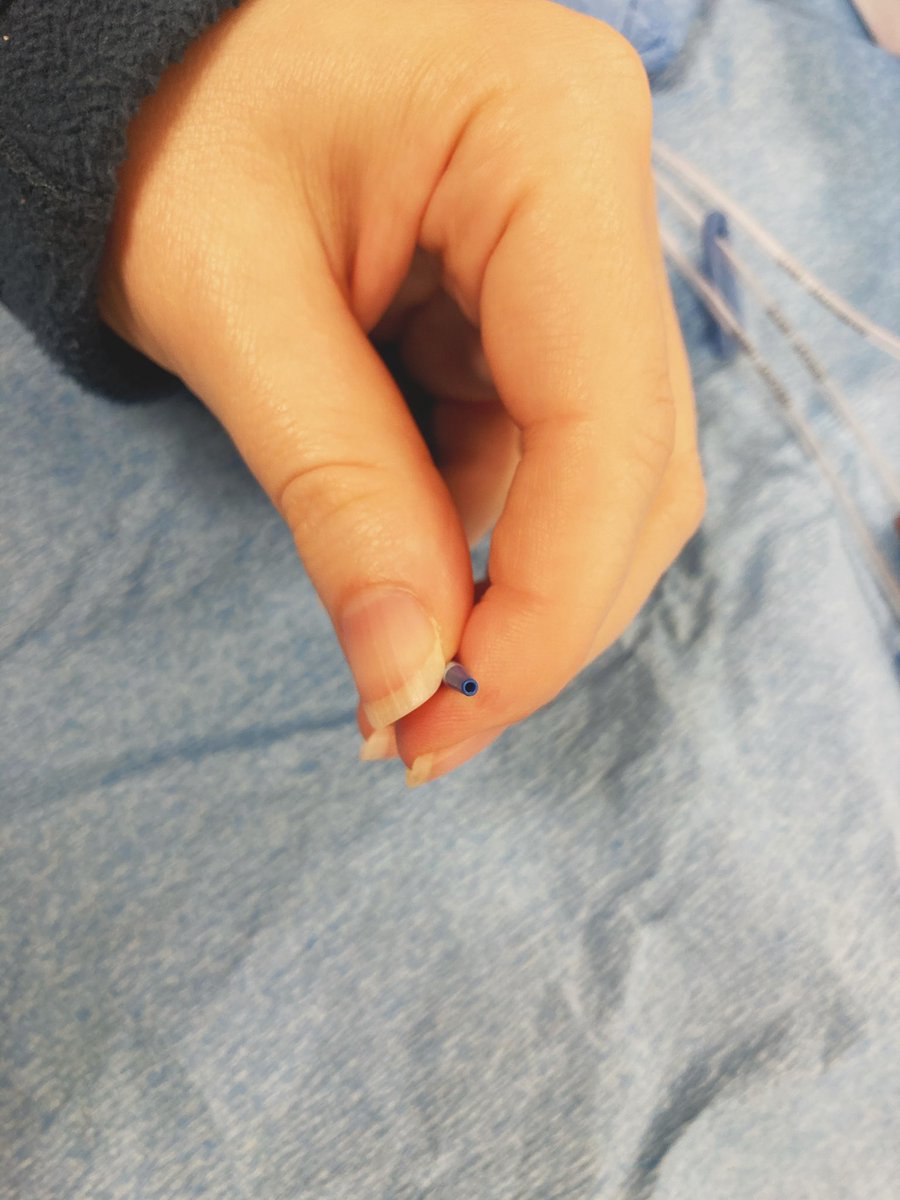 It has three lumens—two 18 gauge side ports and a 16 gauge distal port (the brown port, where your wire will come out). I have developed the habit of flushing the line before I start and making sure I know which is the distal port. Can be NOT the brown port in some lines.