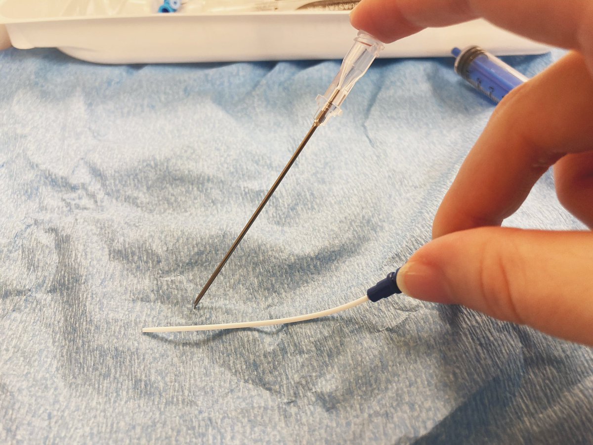 When there’s lots of resp variation, the angiocath can’t accidentally pop out the back after you’ve put down your US to thread.The AC courses with the vessel, so the angle of your wire entering the vessel isn’t steep (can help if you are having trouble threading the wire).