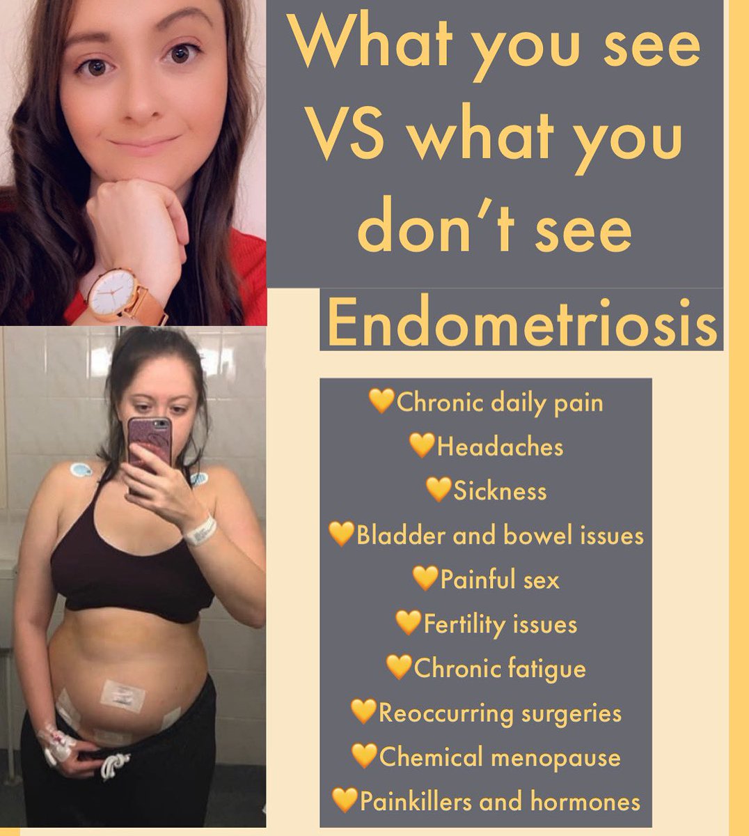 Thought I’d join in #endometriosis