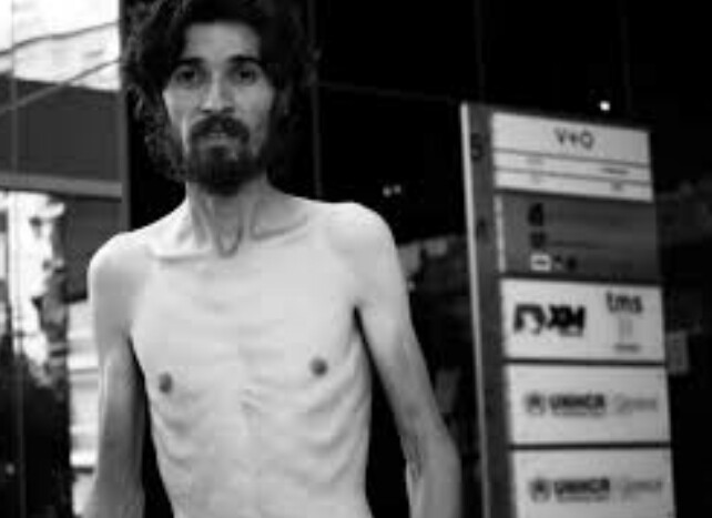 NoahFardad's tweet photo. Many Iranians like Anwar nilufary are forced to engage in hunger strikes to receive basic attention.His life matter.
#UNHCRGREECE
#UNHCRSWEDEN
#انور_نیلوفری https://t.co/5dQQeHbIH7