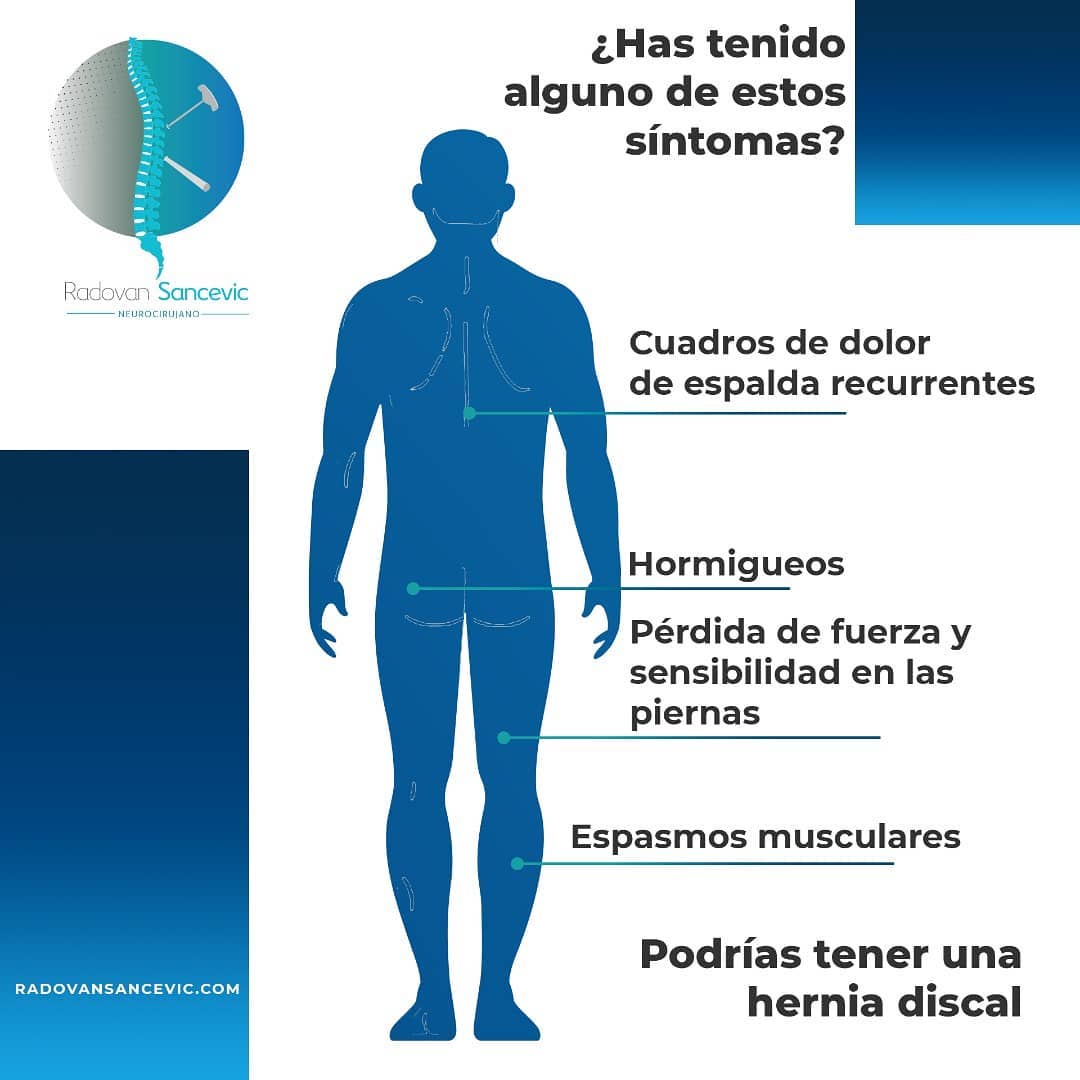 RadovanSancevic's tweet photo. Cuando se produce una hernia de disco, esta puede ejercer presión sobre los nervios espinales adyacentes (radiculopatía) o sobre la médula espinal (mielopatía), lo que provoca síntomas dolorosos.
.
https://t.co/I8LxZEQSjZ https://t.co/APYZGGKNyd