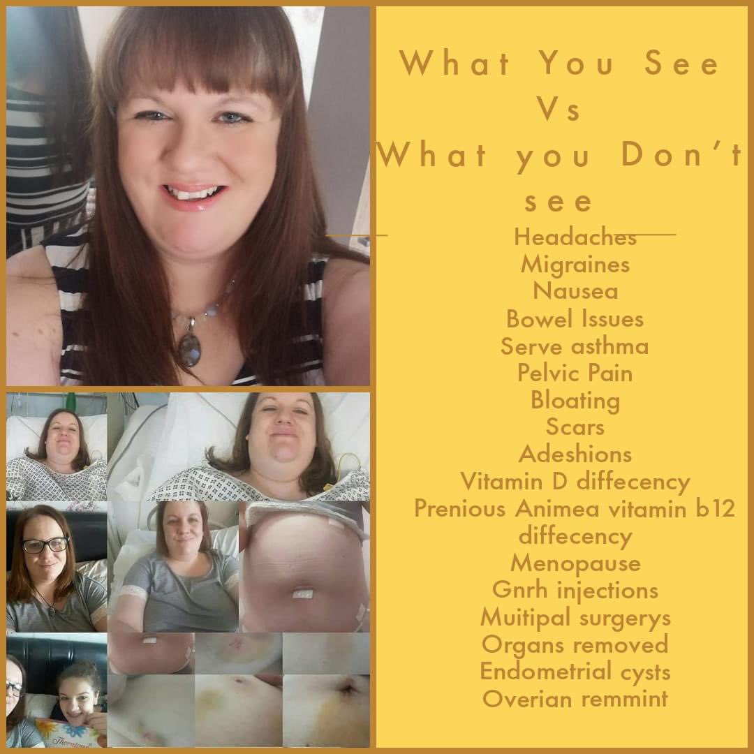 #endometriosis