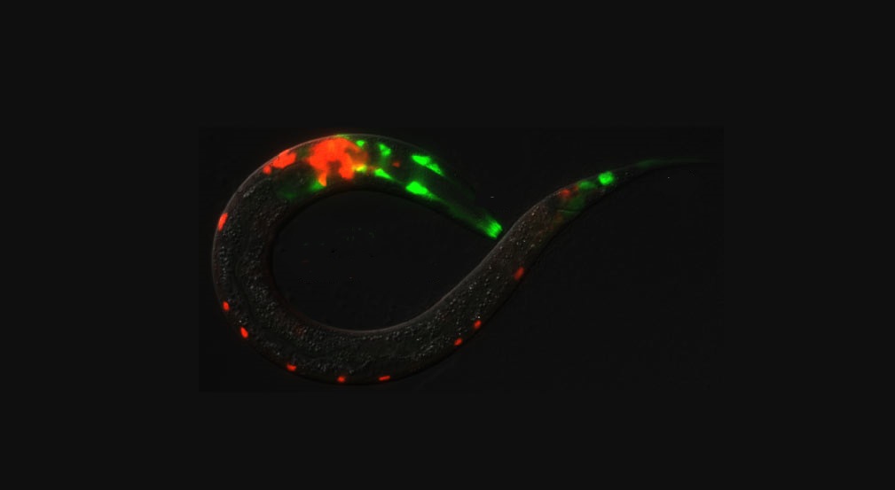 When people think of neuroscience, they often think of neurons, but that is only half the story. Learn all about @SinghviLabGlia’s journey into researching #glia, critical but understudied players in brain function: fredhutch.org/en/faculty-lab…