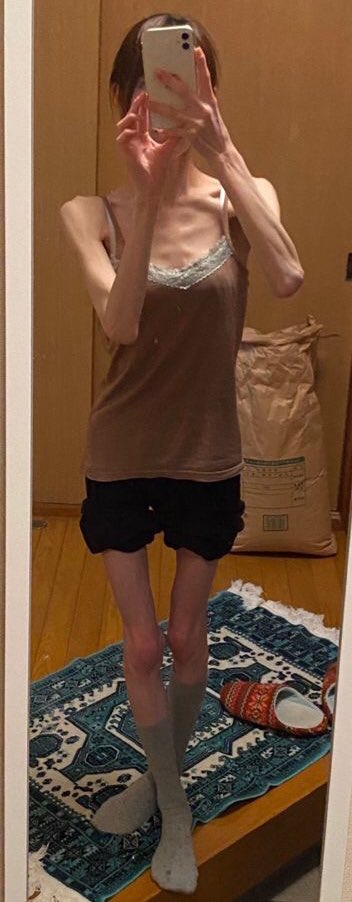 only0calories's tweet photo. chest bones really do be make my heart stop ❤️

#proanatwt #meanspo #thinspo #bonespo #fatspo https://t.co/VwrGaQTswA