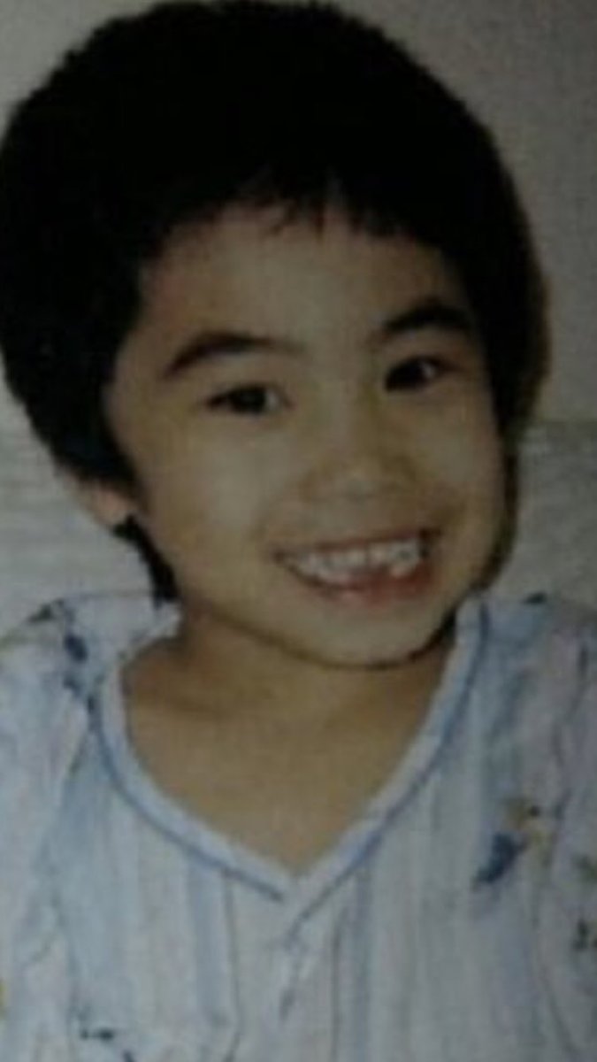 Rocky’s teeth and jaws where normal when he had baby teeth. His occlusion (bite) was the usual upper overlaps the lower teeth.