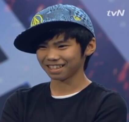 However during his time on Korea’s Got Talent its apparent that his bite is edge to edge making it seem like he has bimaxillary protrusion. Meaning both of his jaws are protruded (forward)