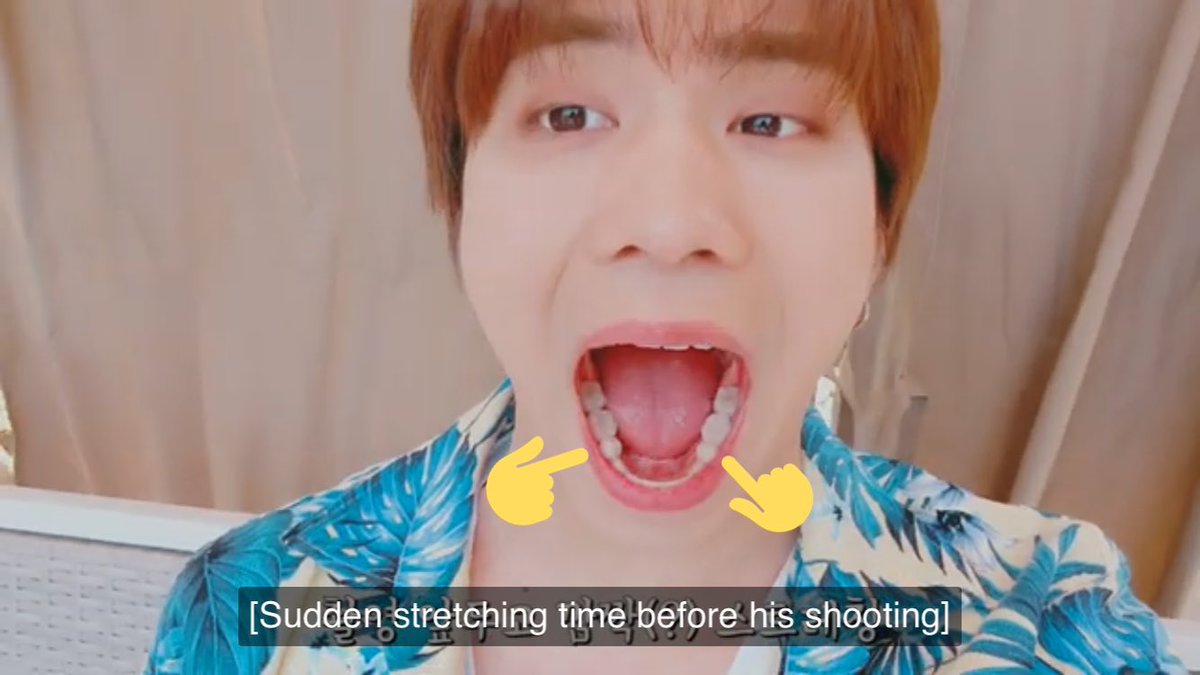 That resulted to him wearing braces and having 4 teeth pulled out during the process to correct his jaws and teeth. On the photo below you can see his profile seems protruded too!  second photo is rocky stretching which also shows us that he has two missing lower premolars.