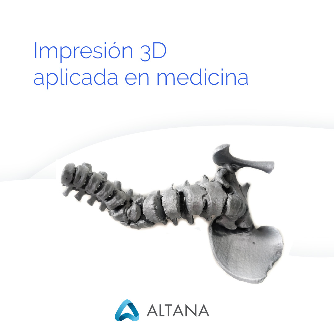 Altana 3D tweet media