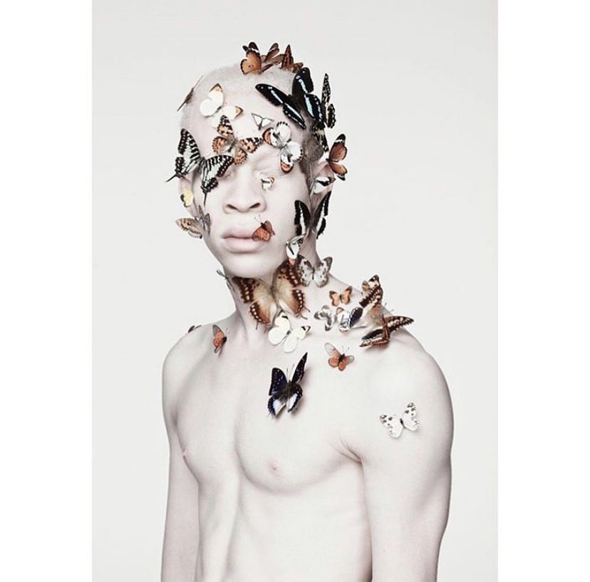 reference_town's tweet image. 🤍| albinism references