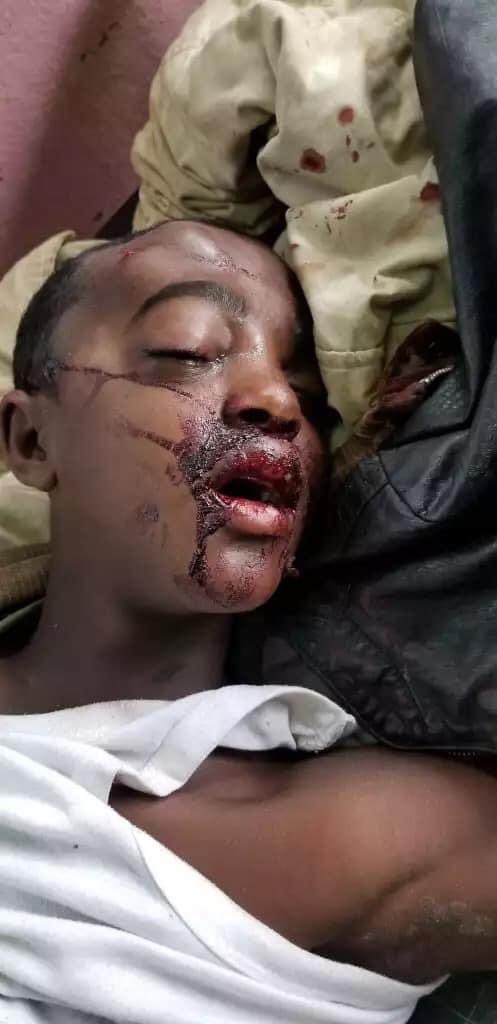 Magartu12's tweet photo. @PMEthiopia Ethiopian government stop killing innocent people shame on you. 😭😭😭😭😭😭😡😡😡 https://t.co/UbIydWbyEp