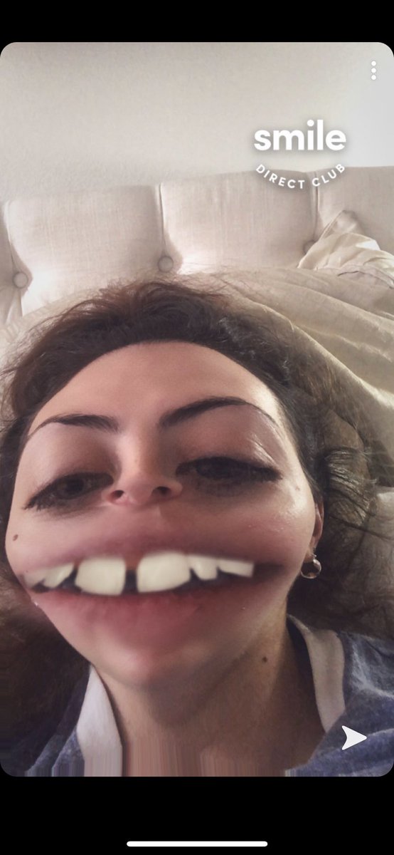 MasonElise_'s tweet photo. This snap filter really be giving me PTSD to before braces https://t.co/nSkCSj0ifB