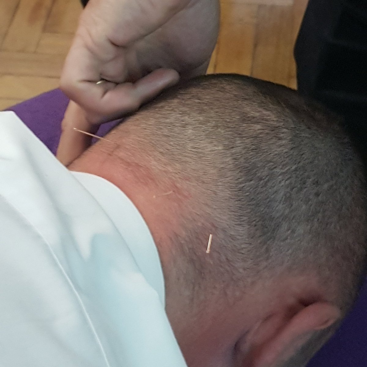 painter_calvert's tweet photo. Did you know that #acupuncture can help with #headaches &amp; #neck #pain? Want to book an appointment or want to know more about our services? Send a message or tel 07711521233. Clinics in #Wickford, #Stanford-le-Hope &amp; #Chafford Hundred.
https://t.co/SXy1zKWAlH 
#osteo #osteopath https://t.co/iLnJfMPEVe