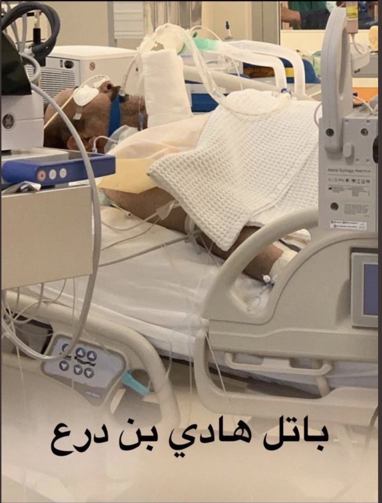جابر سعد المحيلبي (@jaberalmuhailbi) on Twitter photo الأخ وزير الصحة إلى متى والمواطن يعاني من إهمال الطاقم الطبي ..
هذا المواطن انتكست حالته بسبب جرثومة بالدم انتقلت له من سوء العناية ..
ولم يتم التواصل مع أي من أسرته..
للتواصل مع ابو هادي العازمي 66374414
<a href="/Drbaselalsabah/">د. باسل حمود الصباح Dr.Basel Alsabah</a>
<a href="/m_azizaltasha/">م.عبدالعزيز الطشه</a> الأخ وزير الصحة إلى متى والمواطن يعاني من إهمال الطاقم الطبي ..
هذا المواطن انتكست حالته بسبب جرثومة بالدم انتقلت له من سوء العناية ..
ولم يتم التواصل مع أي من أسرته..
للتواصل مع ابو هادي العازمي 66374414
<a href="/Drbaselalsabah/">د. باسل حمود الصباح Dr.Basel Alsabah</a>
<a href="/m_azizaltasha/">م.عبدالعزيز الطشه</a>