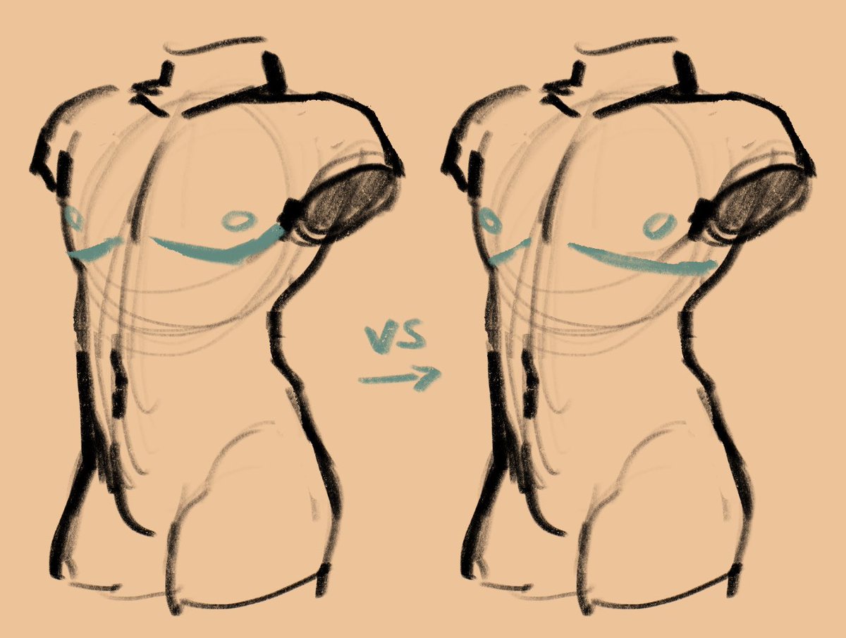 While I know it’s sometimes a stylistic decision I’d like to point out that double incision top surgery scars rarely underline the pectoral muscle perfectly. Not to mention there’s variations in scar shape bc of body type and chest size before surgery!