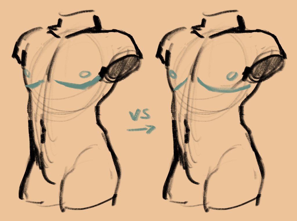My own top surgery scars underline my pecs pretty well, but the scars reach underneath my armpit, instead of curving upwards like I’ve seen in some drawings. Here’s an example based on my own scar shape:
