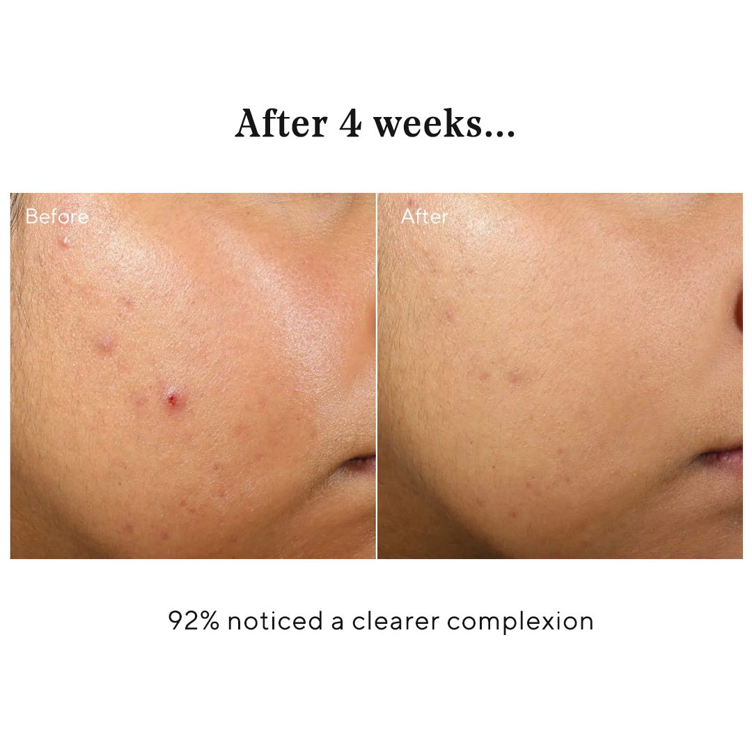 Want to hydrate your way to clear skin with NEW Clarifying Water Gel? We have 1,500 samples to give away of this oil-free, non-comedogenic, water-light hydrator. It hydrates, balances and calms for healthier- and clearer-looking skin.​
.
Want one? Visit bit.ly/trywatergel.