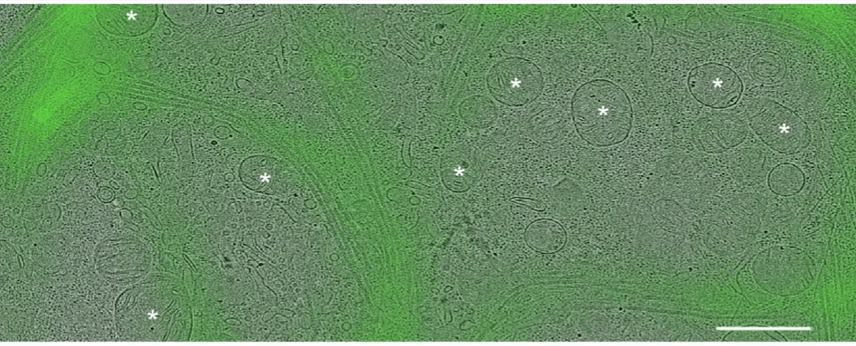 First, we used  #CLEM to locate YFP-tagged  #LRRK2 in HEK cells with the I2020T PD mutation. We selected for MTs decorated with  #LRRK2. Then, we used  #cryoFIB milling and  #cryoET to image the MTs.  6/n