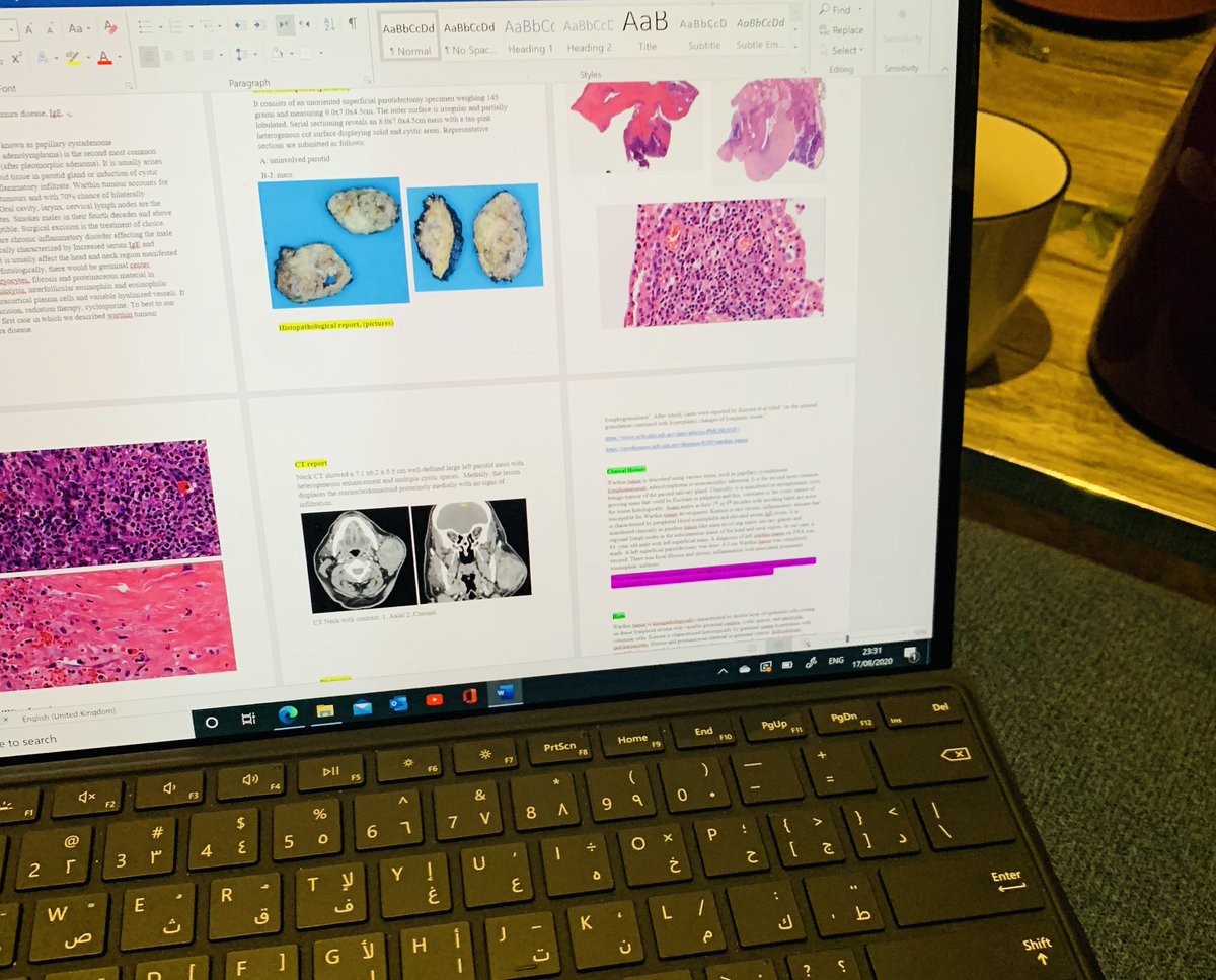 Naheelkhudiri's tweet photo. Stay tuned for my interesting case report on #warthin tumor 🐸. #OralPath https://t.co/HEW0qI4P5S