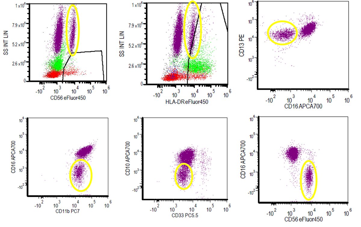 Dr_QayyumS's tweet photo. Flow on peripheral blood. Name the population (yellow circle) #flowcytometry #flowmo #hemepath #flowfriday #peripheralsmears https://t.co/CStV2kAW34