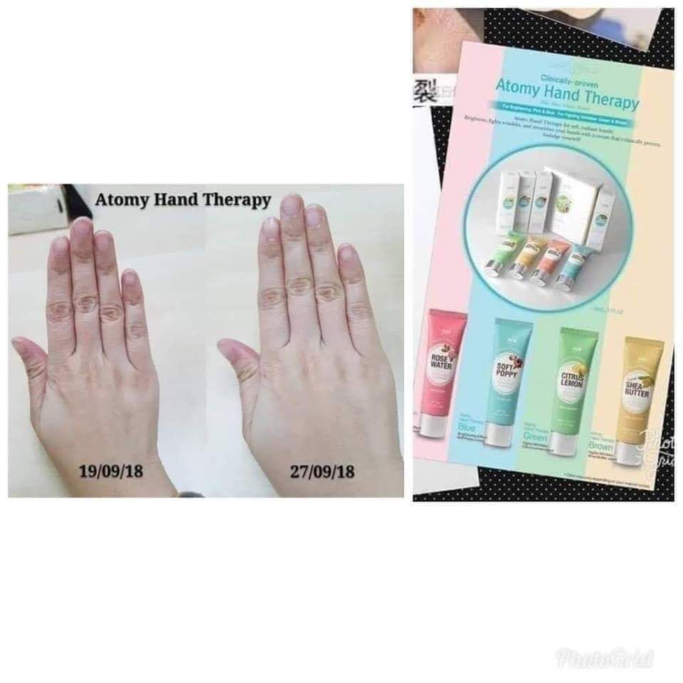 Tan Haw Teck En Twitter 艾多美护手霜男女适合用的 免费注册会员 教你怎么购买https T Co 4zjqdor8w3 Twitter