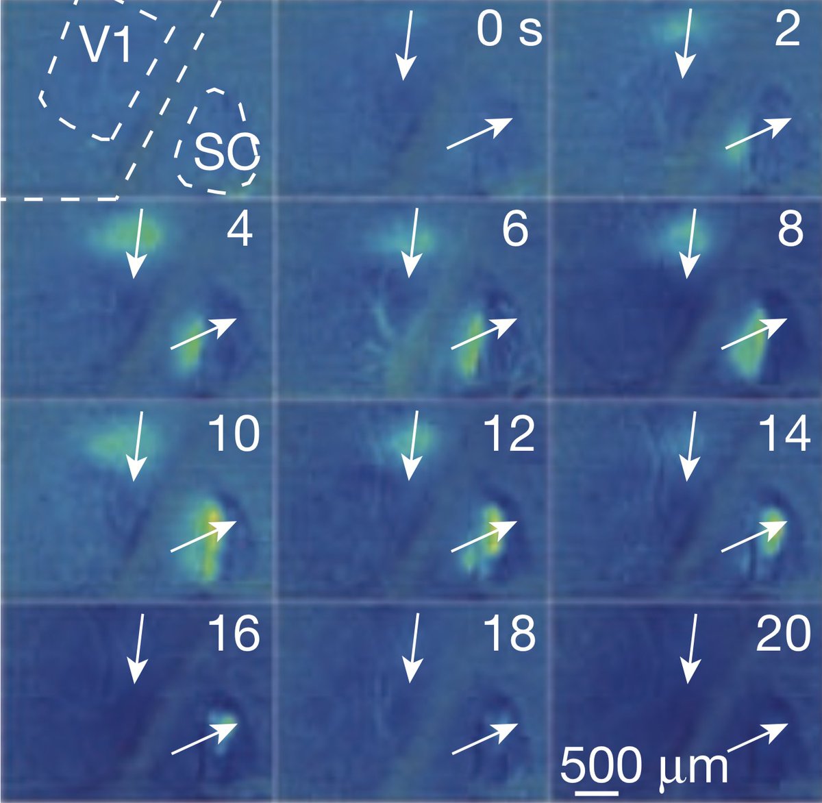 Day 2 of my Twitter  #thesis. Today's topic: How spontaneous waves of activity shape the developing brain(Figure from Ackman et al 2012  https://doi.org/10.1038/nature11529)