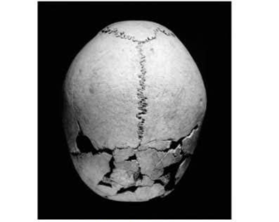 in Verulamium, in the 2-3rd century, a child's skull was carefully defleshed using a small sharp knife. it was then displayed on a post outside of a shrine for sometime before being interred in a shaft, upright, with a whetsone and a the corpse of a puppy.