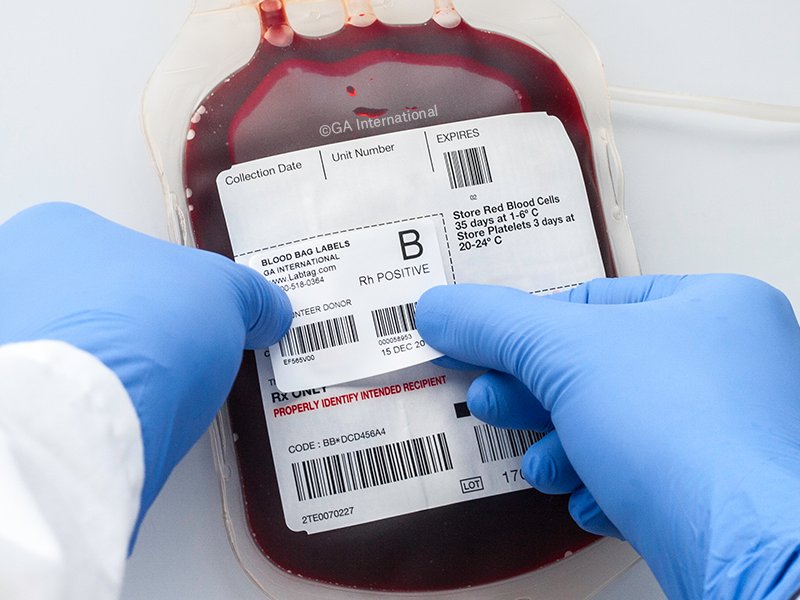 track_blood's tweet photo. Blood trafficking like organ donation is a heavy cost both socially and financially. It is important to be able to trace the source of the blood donation to  provide a safer transfusion.

Tag yourself below if you agree!

#blooddonors 
#Bloodsaves https://t.co/Rx8U9gLVYv
