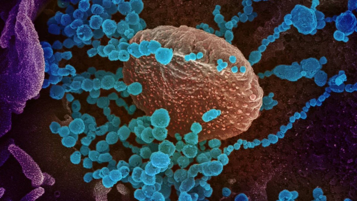 Queridos manifestantes que ayer gritabais querer "ver al virus", aquí lo tenéis bajo un microscopio electrónico. 

Ahora me toca pedir a mí, y lo que yo quiero ver son esas mascarillas bien puestas.