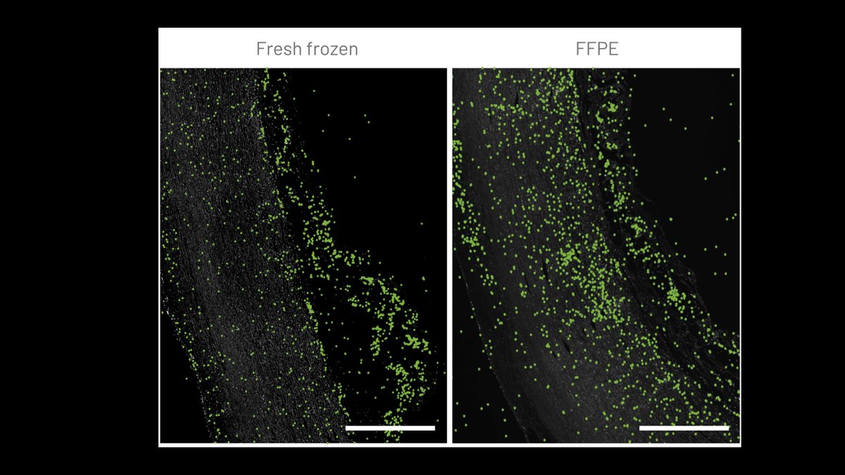 Did you know that CARTANA #InSituSequencing works with Fresh Frozen and FFPE tissue samples? Both tissue preparation methods provide a similar number and distribution of signals. Here, Rplp0 was visualized on human aorta tissue samples with our HS Library Preparation Kit.