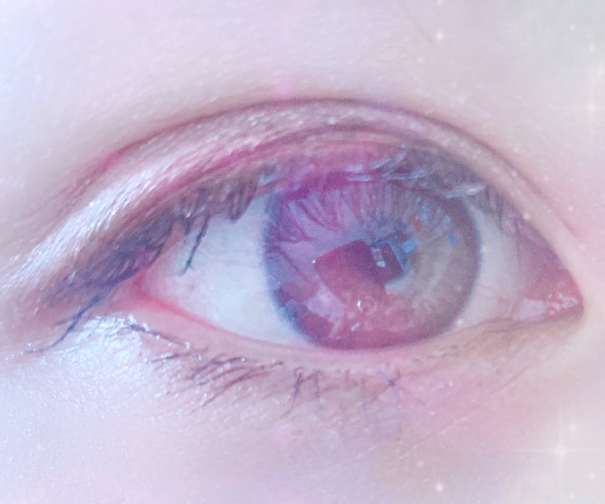 kme_kys's tweet photo. 目の経過
1週間後
→1ヶ月後
最初の5日まではこのままだったらどうしようってほど腫れる
1ヶ月浮腫みやすいから寝起きは腫れた感じだけど、それ以外は安定
#聖心美容
#埋没 https://t.co/3fH8fqrUs9