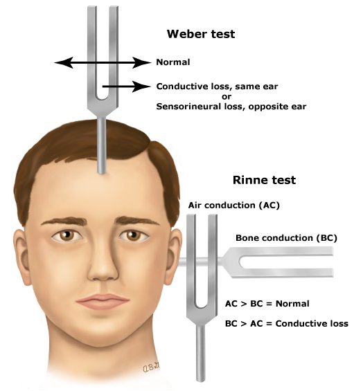 Physio_Graphic's tweet photo. صورة تشرح ( Weber and Rinne test)

الذي يستخدم في التقييم السمعي 👂👨‍⚕️ https://t.co/iPOntNuGnn