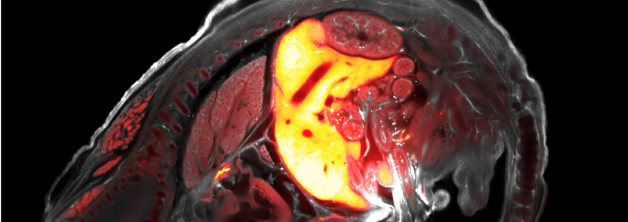 RoyalMicroSoc's tweet image. Registration and abstract submission is now OPEN for the "Virtual 12th Light Sheet Fluorescence Microscopy Conference 2020!"

Find out more and register for FREE here: ow.ly/v90M50B2rHS