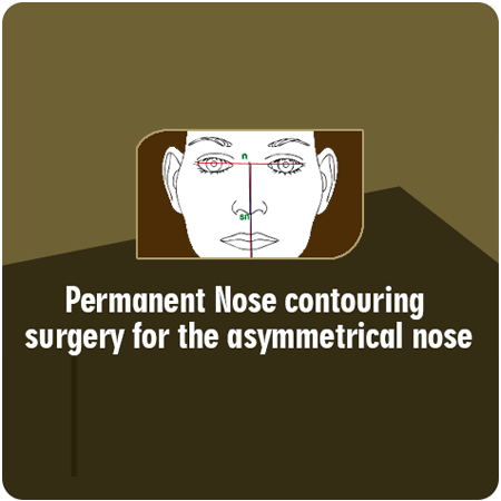 AndeiSoI's tweet photo. Permanent Nose contouring for  asymmetrial nose
#asymmetricalnose #permanant #nosejob #nosecontouring #drsunilrichardson #maxfax https://t.co/KbcIA0m2LC