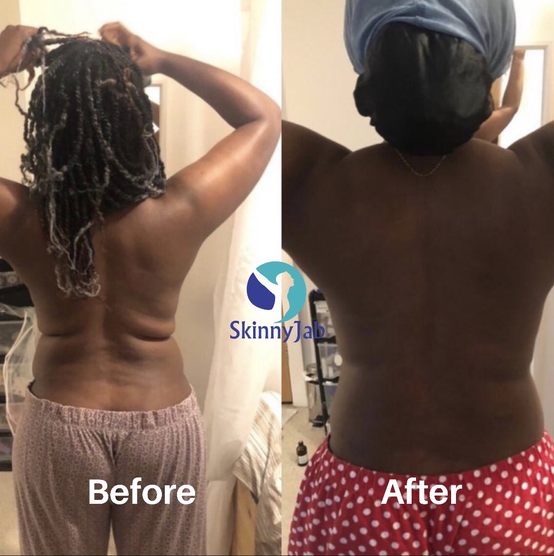 Happy #transformationtuesday ✨ Here’s one of our clients progress, a month apart from each other! How amazing is this 😍

#bodytransformations #bodyprogress #losingweightjourney #weightlossjourney #weightlossuk #weightlossupport