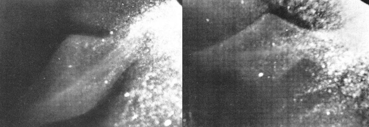 Three seemed to show objects. These photos were said to have been taken at the same time as sonar contact with the supposed objects was made, though it’s never been stated how this was established since the images weren’t time-stamped.