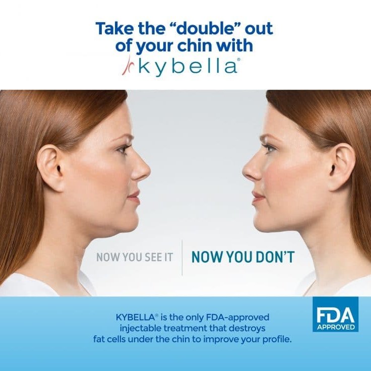 AlabamaMedGroup's tweet photo. Alabama Medical Group is offering special pricing on Kybella®: $100 discount off of one treatment, or $300 off two treatments. Offer valid until Aug. 31. Call 414-5900 or visit https://t.co/dln0X6h6di to schedule your appointment with Dr. Clare Carney today. https://t.co/DL8WDos5KJ