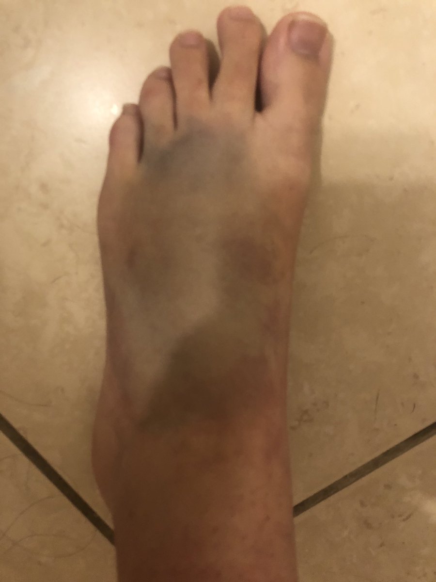 toillettoy's tweet photo. I wonder how many people put rice on their injuries by accident https://t.co/tQDKsL9Iol