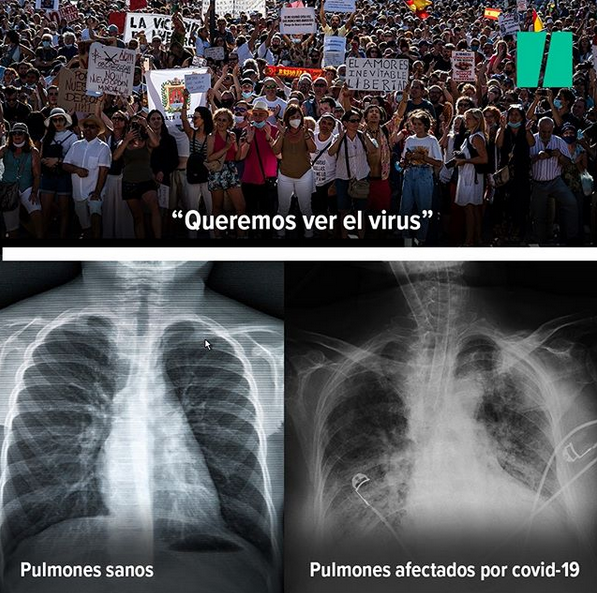 ElHuffPost's tweet photo. -"Queremos ver el virus"
Pues abajo a la derecha 👇 https://t.co/838lgc5ElR